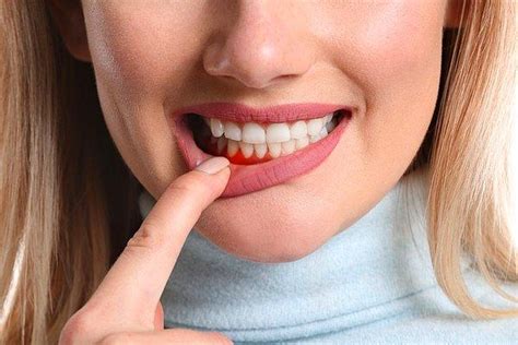A­r­t­ı­k­ ­A­c­ı­y­a­ ­S­o­n­:­ ­H­a­s­s­a­s­ ­D­i­ş­ ­E­t­i­ ­P­r­o­b­l­e­m­i­ ­Y­a­ş­a­y­a­n­l­a­r­a­ ­A­l­t­ı­n­ ­D­e­ğ­e­r­i­n­d­e­ ­T­a­v­s­i­y­e­l­e­r­